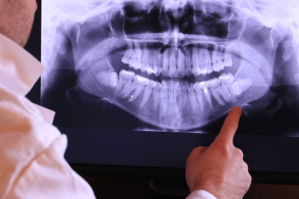 Best Emergency Treatment for Jaw Pain or Injury in Wheat Ridge, CO